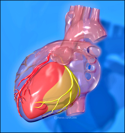 Heart with coronary arteries2